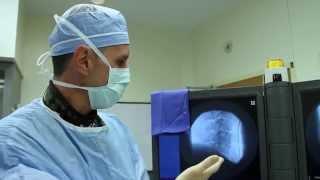 Anterior Cervical Discectomy and Fusion (ACDF)