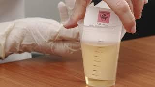 Dried Urine