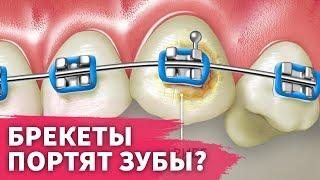 Брекеты портят эмаль зубов?