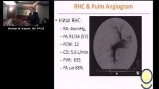 Chronic Thromboembolic Pulmonary Hypertension (Michael M. Madani, M.D.)  January 21, 2016