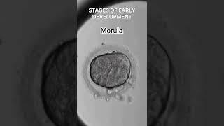 Early development of human | Cleavage | morula | blastulation