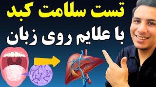 تشخیص بیماری ها با نگاه کردن به زبان| تست سلامتی با قاشق