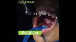 Professional Teeth Cleaning & Polishing by Sabka Dentist Experts