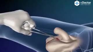 성전환수술 과정 시뮬레이션 수술영상