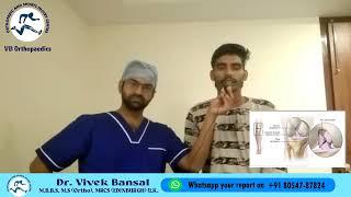 ACLLigament #Knee Injury #Best Knee Surgeon #Dr Vivek Bansal #Sports Injury Specialist