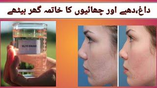 Dark spots, pigmentation 7 Days Removal Challenge||100% results