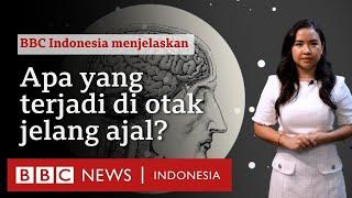 Apa yang terjadi pada otak setelah kita meninggal dunia? - BBC News Indonesia