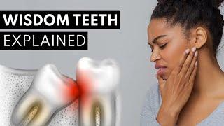 Wisdom Teeth Explained (Pain, Symptoms, & Extractions)