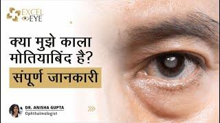 क्या मुझे काला मोतियाबिंद है? What is Glaucoma or Kala Motia? Dr Anisha Gupta - Eye Doctor in Delhi