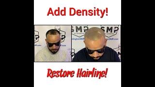 Densify Thinning Hair  with Scalp Micropigmentation