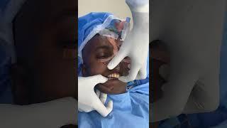 Unable to open mouth cause of TMJ ankylosis - before surgery shorts