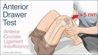 Anterior Drawer Test - A Chiropractic Online CE™ Production