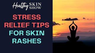 Best STRESS RELIEF TIPS For Skin Rashes | Jennifer Fugo