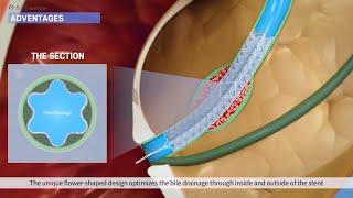 [의료] 췌담관 스텐트 튜토리얼 및 홍보영상제작 | S&G바이오텍