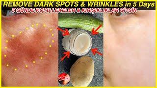 With Potato - Cucumber Face Cream, I Removed DARK CIRCLES - WRINKLES in 5 Days! Skin Whitening