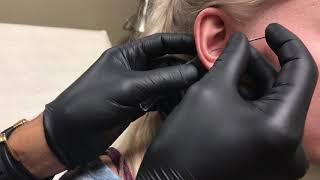 Getting My Conch Pierced