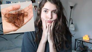 DONE WITH ACCUTANE | CLEAR SKIN & HAIR LOSS??