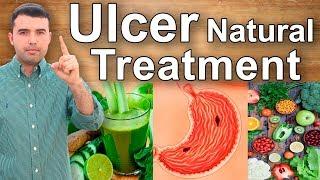 How to Cure Gastric Ulcers Caused by Gastritis - Home Remedies, Juices and Supplements for Ulcers