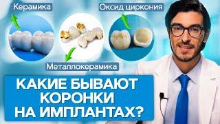 Какие бывают коронки на имплантах? Какие коронки устанавливают на имплантах и с какой фиксацией?