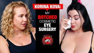 Korina Kova: My Botched Cosmetic Eye Surgery