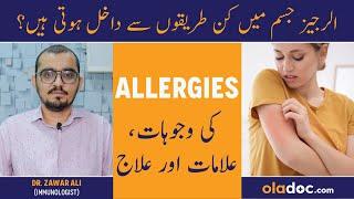 Allergy Ka Ilaj In Urdu - Allergies Symptoms Treatment - Allergy Ki Alamat - How To Treat AllergIes