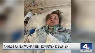 Mother of woman run over, beaten in Garden Grove speaks out