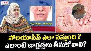 సోరియాసిస్ ఎలా వస్తుంది ? ఎలాంటి జాగ్రత్తలు తీసుకోవాలి? | The Precautions Take Psoriasis| CVR Health