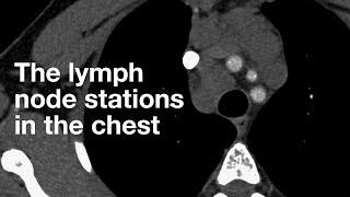 The Lymph Node Stations in the Chest