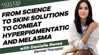 From Scinece to Skin: Solutions to Combat Hyperpigmentation and Melasma with Danielle Renee