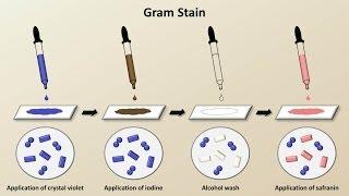 Classification of Bacteria (Antibiotics - Lecture 1)