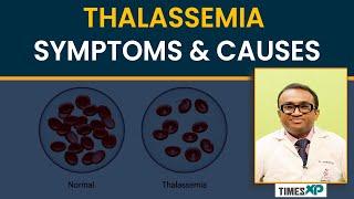 Thalassemia Explained: Symptoms, Causes, and Treatment Options | How to Manage It | TimesXP