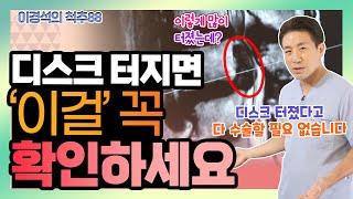 디스크 터졌다고 다 수술하는 건 아니다? - 이경석의 척추88 #98 - 디스크 파열 치료