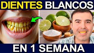 ALERTA! DIENTES AMARILLOS - Como Blanquear Los Dientes En Casa Para Que No Tener Mal Aliento