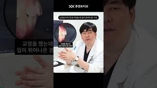 치아교정 다 끝났는데 입툭튀, 돌출입인 이유는? #shorts