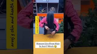 How Lice Remove at Home Remedies/Remove Lice From Hair #shorts #haircare #liceremoval #youtubeshorts