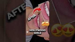 From Flawed to Flawless  Smile Makeover Reveal!