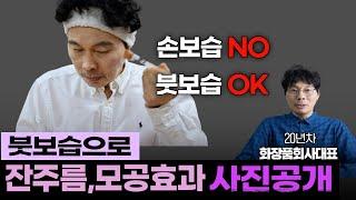 손보습하고 차원이 다른 붓보습 효과(주름,모공before & after사진공개)