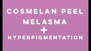 Cosmelan Peel for Hyperpigmentation and Melasma | Total Dermatology