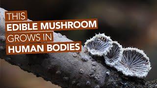 This Edible Mushroom Grows In Human Bodies