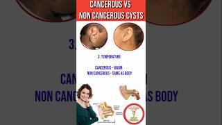 Cancerous  Vs Non cancerous cysts | How to identify Cancerous cysts