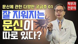 [문신제거] 잘 지워지는 문신이 따로 있다?