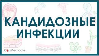 Кандидозные инфекции - кратко причины, симптомы, диагностика, лечение