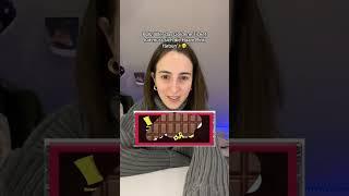 Wer hat das Goldene Ticket??! ️ Emir Bayrak #emirbayrak #viral #tiktok #shorts