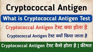 Cryptococcal Antigen Test in hindi | Symptoms & Price of Cryptococcal Antigen Test.