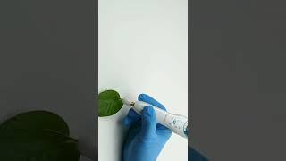 Plasma Pen: Erase Stretch Marks & Rejuvenate Skin #shorts