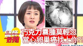 巧克力囊腫莫輕忽，當心卵巢癌找上你？！【#醫師好辣】20210407 part4 EP1128 鄭丞傑 邱鴻傑