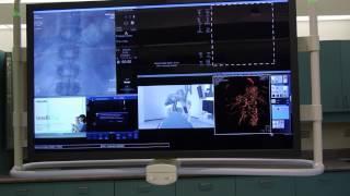 Inside Grand River Hospital's new interventional radiology suite