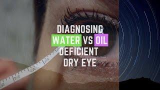 Diagnosing Oil vs Water Deficient Dry Eye Using Zone-Quick Test