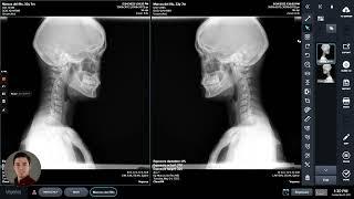 Dragon Portable X-ray with Wireless DR panel Training