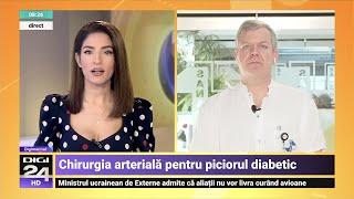 Chirurgia arterială pentru piciorul diabetic – Dr. Ionuț Munteanu | Spitalul Clinic SANADOR